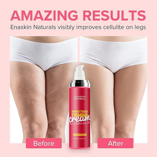 Anti Cellulite Body Firming Cream: Cellulite Remover for Legs & Inner Thigh- Skin Tightening Lotion for Womens' Booty, Stomach & Belly with Acetyl Hexapeptide-8 & Caffeine, 100 ML