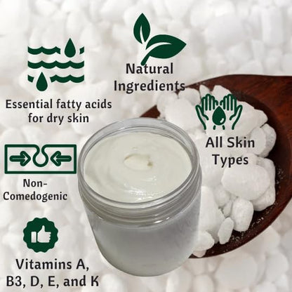 Beef Tallow & Magnesium Body butter - Grass Fed and Finished beef tallow Magnesium Cream- Handmade moisturizer for Cracked, Dry, Itchy skin- eczema cream- diaper rash (SANDALWOOD VANILLA)