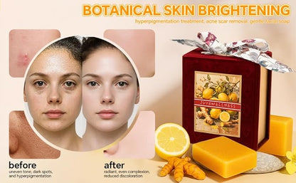 Natural Turmeric & Lemon Soap for Even Skin Tone, Acne-Prone Skin Care,Handmade, Luxury Bath & Shower Gift,gentle effective, plant-based cold processed natural soap gift set (2 pack)
