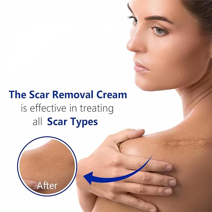 Advanced Scar Gel for Surgical Scars, Face, Body, Legs, Burns, Acne, C-Section, Stretch Marks, Keloids - Effective Scar Removal for Men and Women, Suitable for Old & New Scars (100% New -2 Bottle)