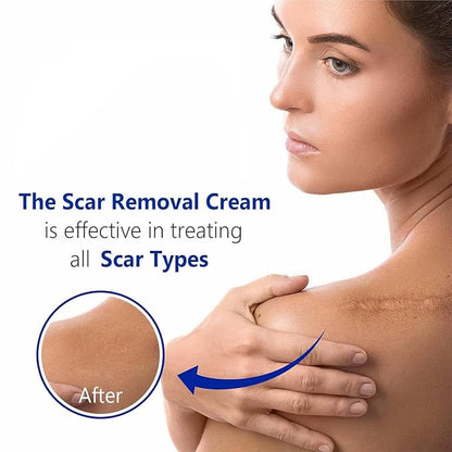 Advanced Scar Gel for Surgical Scars, Face, Body, Legs, Burns, Acne, C-Section, Stretch Marks, Keloids - Effective Scar Removal for Men and Women, Suitable for Old & New Scars (100% New -1 Bottle)