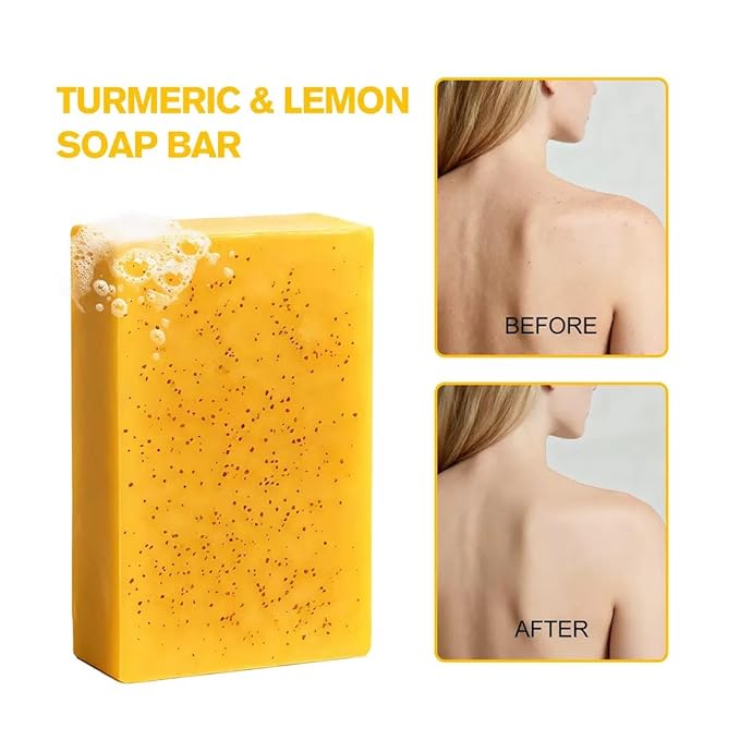 Lemon Turmeric Kojic Acid Soap, Natural Turmeric Handmade Soap for Face and Body, Organic Use Skin Care Soaps, Gentle Cleansing Suitable for All Skin Types (3pcs)