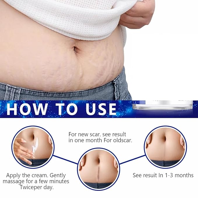 Advanced Scar Gel for Surgical Scars, Face, Body, Legs, Burns, Acne, C-Section, Stretch Marks, Keloids - Effective Scar Removal for Men and Women, Suitable for Old & New Scars (100% New -2 Bottle)
