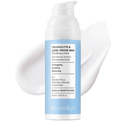 Folliculitis Acne Lotion for Body: Helps Reduce Itch, Redness, Body Acne, Bumps & Uneven Texture with Salicylic & Glycolic Acid + Botanicals - Gentle Care for Folliculitis-Prone Skin
