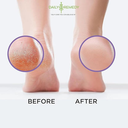 Calming Lavender Foot Soak with Epsom Salt, Made in USA, Foot Soak Soothes Tired Feet, Athletes Foot, Stubborn Foot Odor, Softens Calluses & Helps Treat Toenail, 16 oz 1 lb