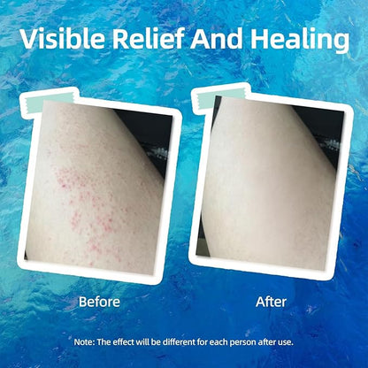 Crogooe Natural Soothing Eczema Cream With Sea Moss Aloe Vera Oats for Multiple Skin Types Comfort Moisture Hydrate Eczema Cream for Dry Skin 4FL Oz