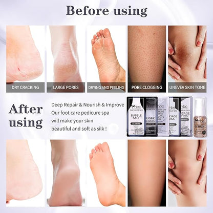 Pedicure Foot Soak Set - Upgraded 6 in 1 Foot Spa, Foot Bath Spa, Pedicure Kit, Foot Soak for Tired & Dry Cracked Feet, Athletes Feet, Bad Odor, Softens Calluses,Golden Petals