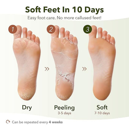 Purederm Shiny & Soft Foot Peeling Mask (3 pack) - For smooth and moist baby skin with Exfoliating peel off Calluses, Dry Skin, Cracked Heels - Men and Women