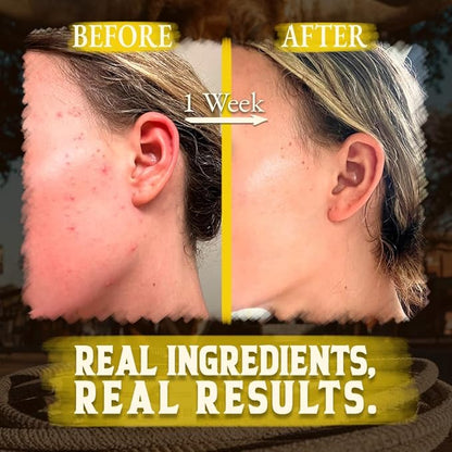 Organic Beef Tallow for Skin - 4 OZ (Citrus) — Grass Fed Beef Tallow for face + Body — US-Made Whipped Tallow and Honey Balm Moisturizer for Dry and Sensitive Skin, Eczema, Rosacea (No Additives)