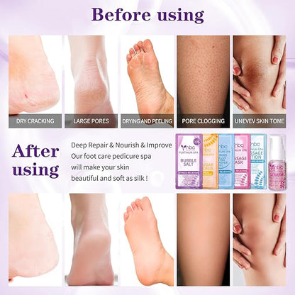 Pedicure Kit Foot Soak Set: Bubble Salt, Sugar Scrub, Massage Mask, Massage Lotion in a Box, 4 Step Foot Spa Kit for Dry Feet,Tired Feet(Lavender)
