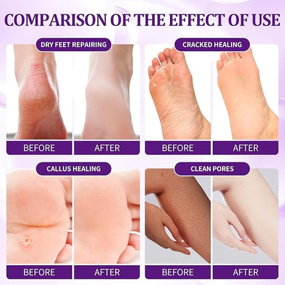 24 PCS Foot Soak, Pedicure Kit Foot Soak Set With Bubble Salt, Sugar Scrub, Massage Mask, Massage Lotion In a Box 4 Step Foot Spa Kit For Dry Cracked Feet, Tired Feet, 6 Set Lavender