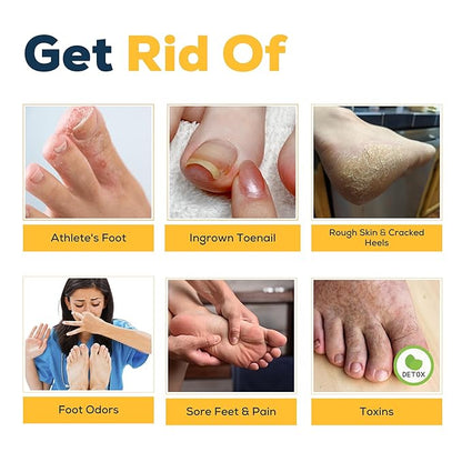 FOOT CURE Citrus Detox Foot Soak with Epsom Salts – for Foot Callus, Damaged Toenail Appearance, Pedicure Spa, and Soothing Sore, Tired Feet - 16 oz (Pack of 1)