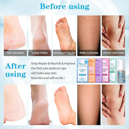 Pedicure Foot Soak Set - Upgraded 6 in 1 Foot Spa, Foot Bath Spa, Pedicure Kit, Foot Soak for Tired & Dry Cracked Feet, Athletes Feet and Calluses (Pacific Waves)