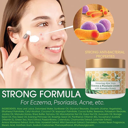 Manuka Honey Eczema Cream Moisturizing Lotion For Psoriasis Relief - Itchy, Dry Skin Rash Ointment -Skin Soothing Moisturizer Baby Kids & Adults-High Strength Body & Face Cream 16oz
