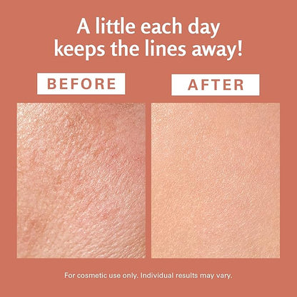 Frankincense Essential Massage Oil for Scars, Stretch Marks & Fine Lines, Firming, Hydrating, Smoothing & Calming Formula with Collagen, Stem Cells, Lavender & Grapefruit, 8 fl oz, by M3 Naturals
