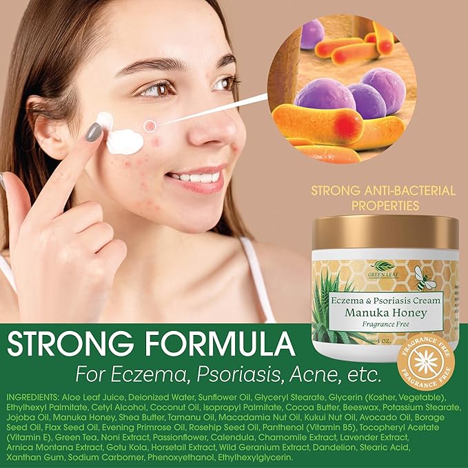 Manuka Honey Eczema Cream Moisturizing Lotion Fragrance Free For Psoriasis Relief - Itchy, Dry Skin Rash Ointment - Skin Soothing Moisturizer - Body & Face Cream - Kids & Adults 2oz