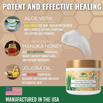 Manuka Honey Eczema Cream Moisturizing Lotion Treatment for Psoriasis Relief - Itchy, Dry Skin Rash Ointment - Soothing Moisturizer for Baby, Kids, Adults - High Strength Body & Face Cream 2oz